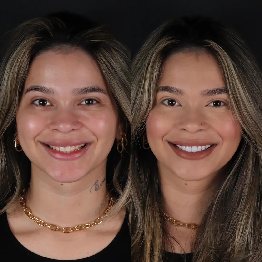 Antes e depois — caso 1